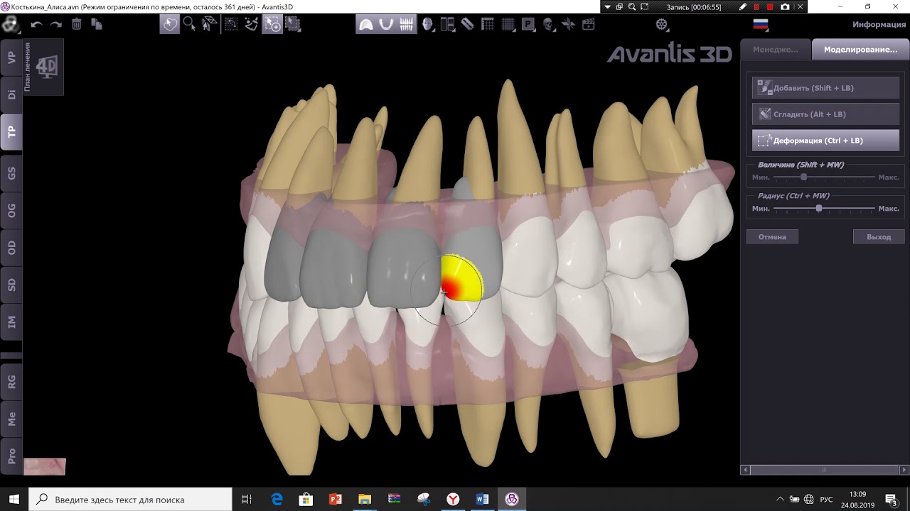 ПО для 3D моделирования зубов Avantis 3D.