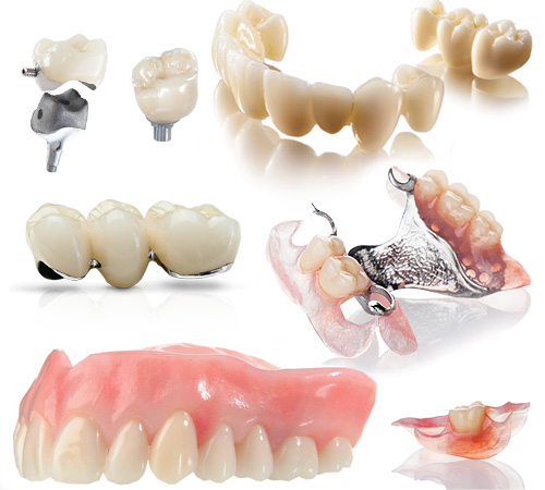 Types of dentures - what are dental prosthetics?